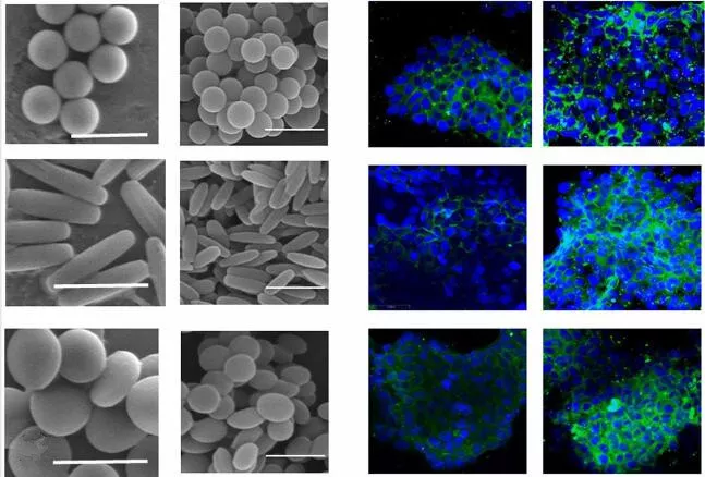 Qual o método recomendado para determinação da forma das partículas utilizando esferas cerâmicas de zircônia para moagem